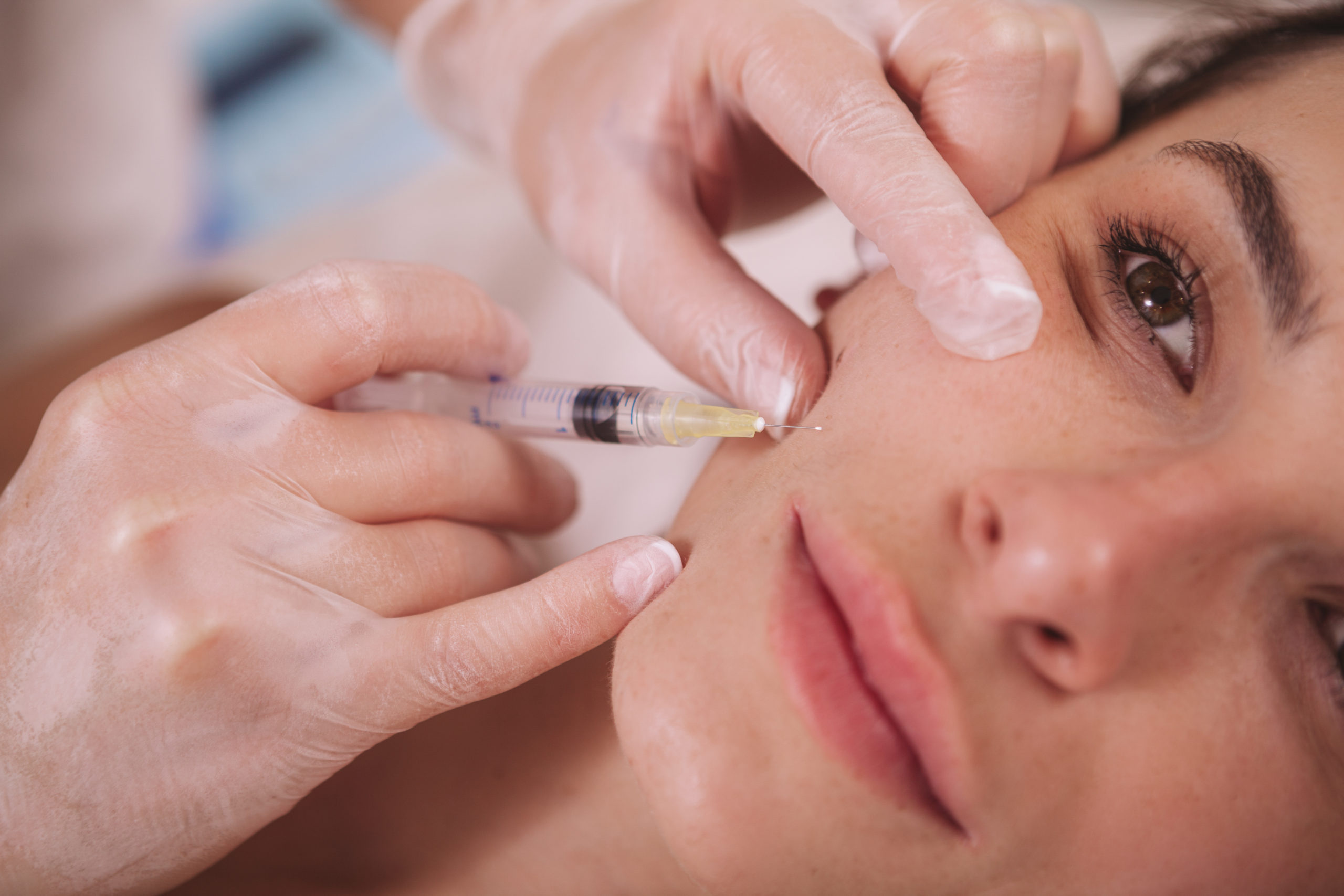 You are currently viewing Who Can Do Dermal Fillers in Fort Lauderdale Florida?